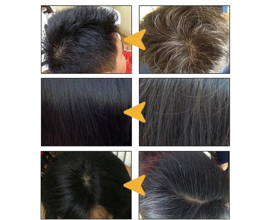 Anti Gray Hair Shampoo Treatment