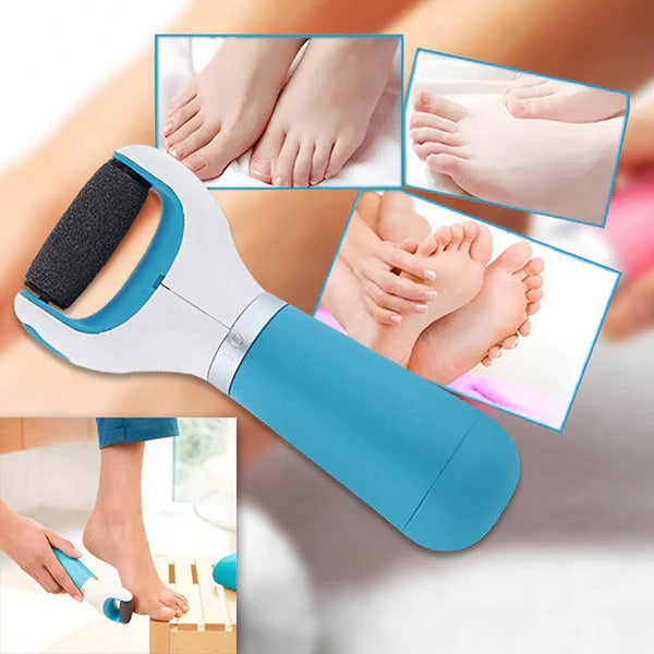Electric Callus Remover for Smooth Feet