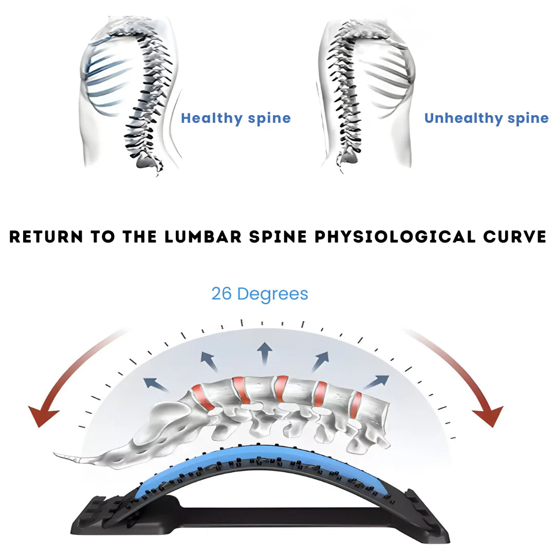 Spinal Decompression Arch for Back Relief and Posture Correction
