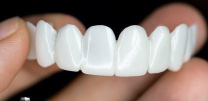 Removable Dental Veneers with Custom Moldable Fit and Natural Look Coverage, Reusable