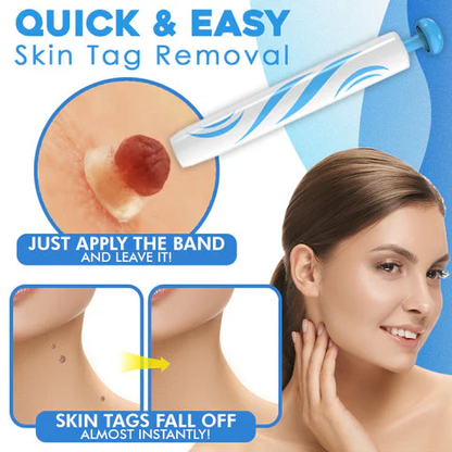 Skin Tag Removal Kit with Dual Spring Applicators and Blood Flow Restriction