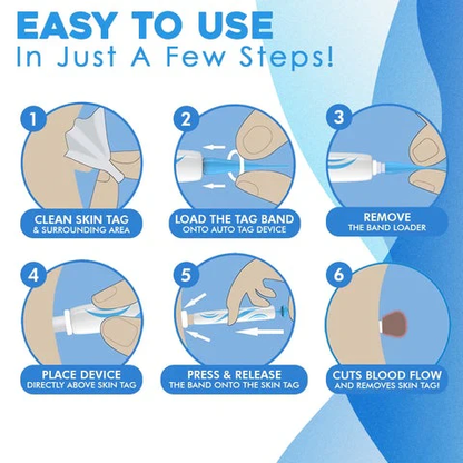 Skin Tag Removal Kit with Dual Spring Applicators and Blood Flow Restriction