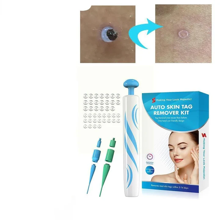 Skin Tag Removal Kit with Dual Spring Applicators and Blood Flow Restriction