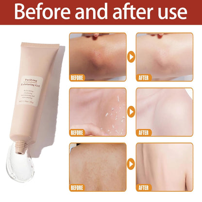 Exfoliating Gel with Sodium Hyaluronate and Cherry Blossom Extract for Face and Body