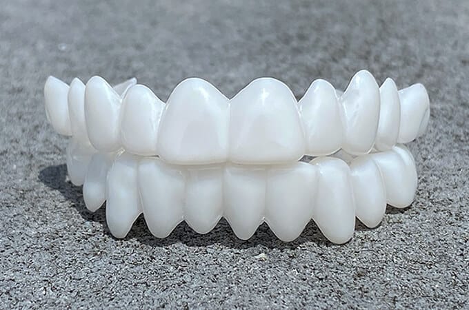 Removable Dental Veneers with Custom Moldable Fit and Natural Look Coverage, Reusable