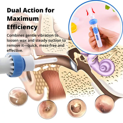 Electric Ear Wax Removal Tool with Silicone Tip and 60-Minute Battery, Portable Design