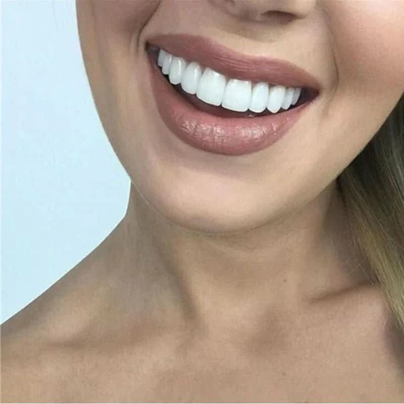 Customizable Dental Veneers  Snap-On Teeth Whitening Solution - Product example