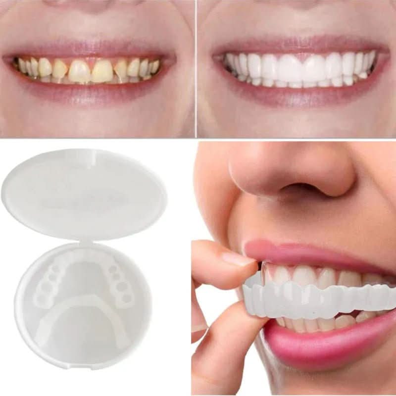 Customizable Dental Veneers  Snap-On Teeth Whitening Solution - Product detail 4