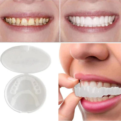 Customizable Dental Veneers  Snap-On Teeth Whitening Solution - Product detail 4