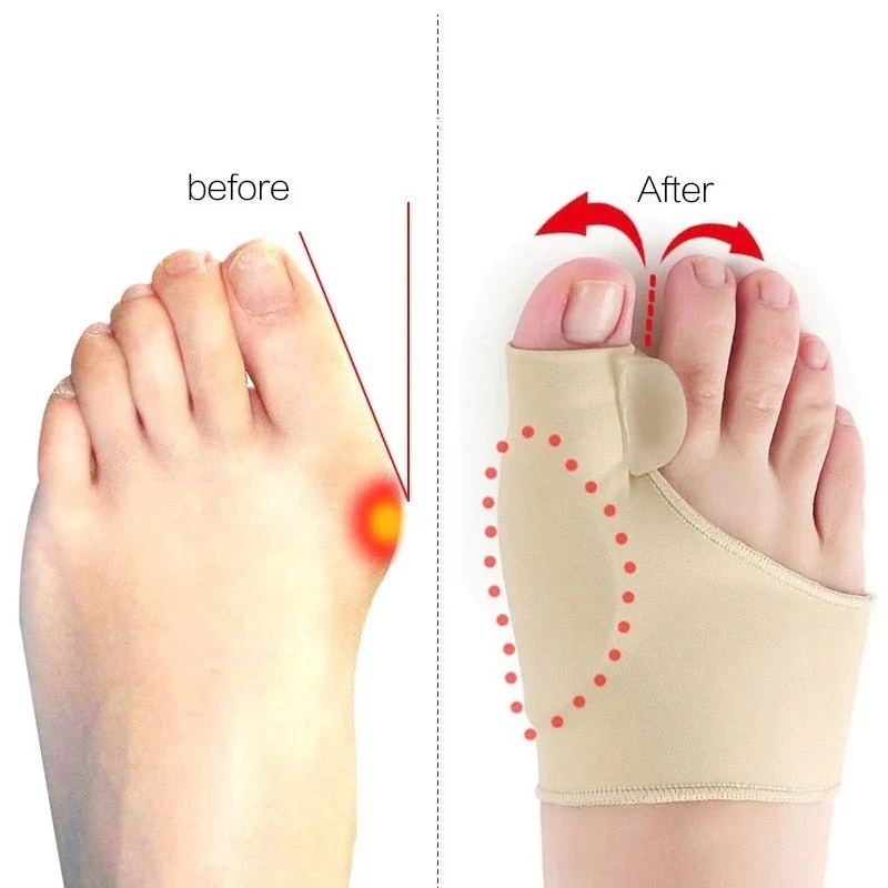 Toe Separator with Alignment Support