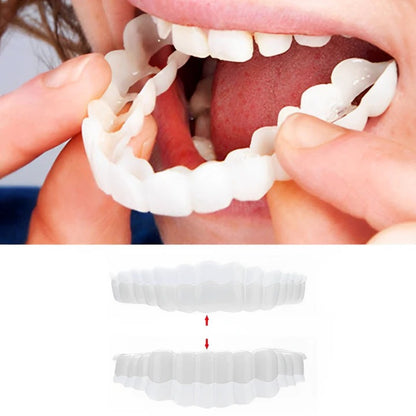 Removable Smile Veneers for Upper and Lower Teeth