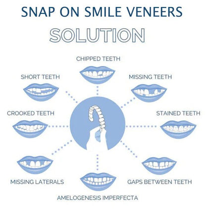 Removable Smile Veneers for Upper and Lower Teeth