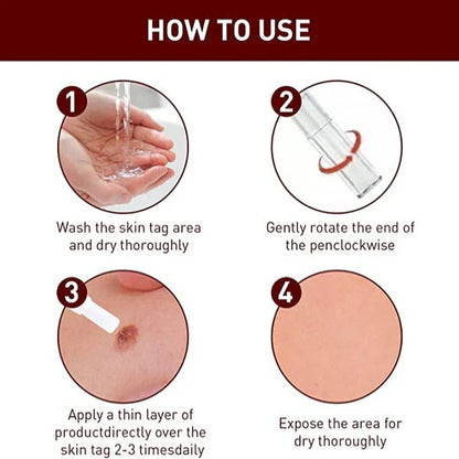 Skin Tag and Mole Appearance Cosmetic Oil