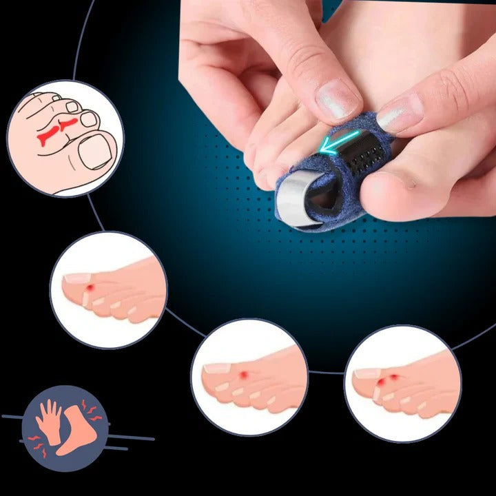 Adjustable Toe Support, Straightener Splint for Foot Pain Relief