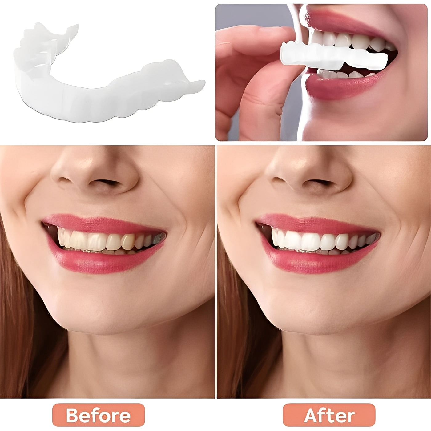 Cosmetic Veneers for Teeth Natural White Finish
