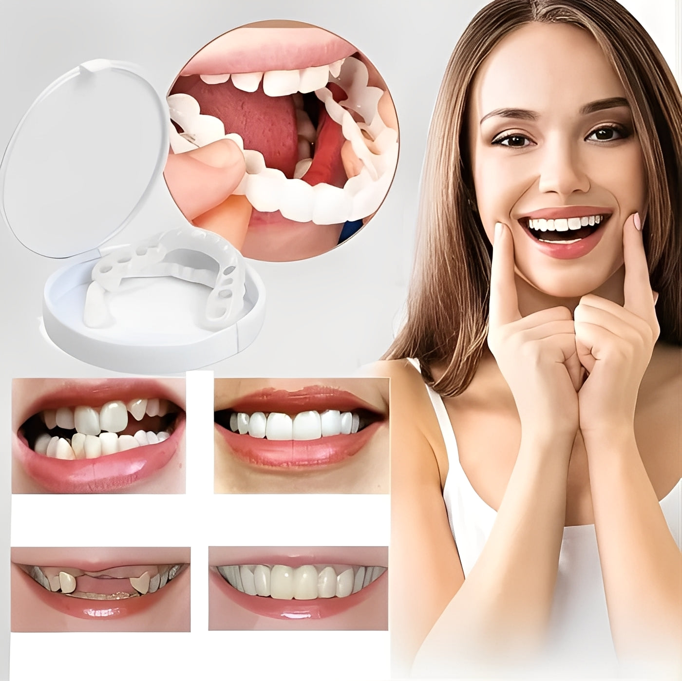 Cosmetic Veneers for Teeth Natural White Finish