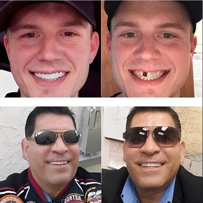 Snap-On Dentures Adjustable for Better Fit and Appearance