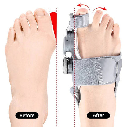 Ergonomic Toe Spacer for Bunions Correction and Support