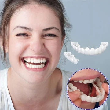 Smile Veneer (Upper & Lower Included)