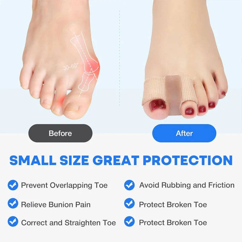 Toe Separator & Bunion Corrector