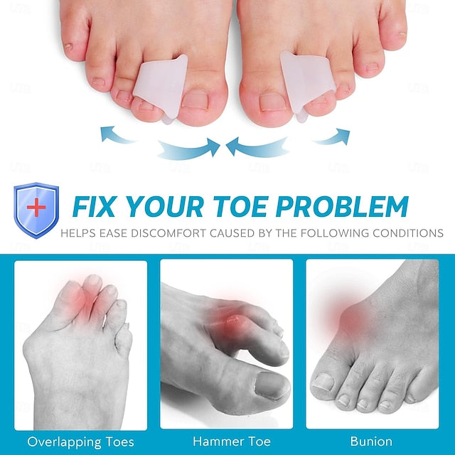 6 Pack Hammer Toe Corrector Splint with Toe Spacers for Bunions and Curled Toes in Men and Women