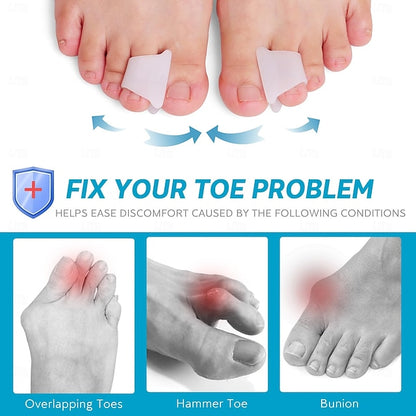 6 Pack Hammer Toe Corrector Splint with Toe Spacers for Bunions and Curled Toes in Men and Women