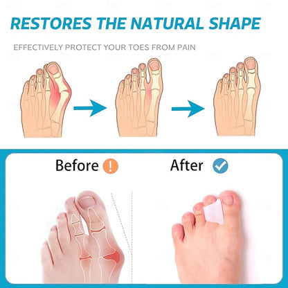 6 Pack Hammer Toe Corrector Splint with Toe Spacers for Bunions and Curled Toes in Men and Women